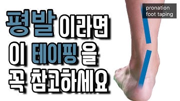 평발이라면 정말 간단한 이 테이핑을 주목 해주세요