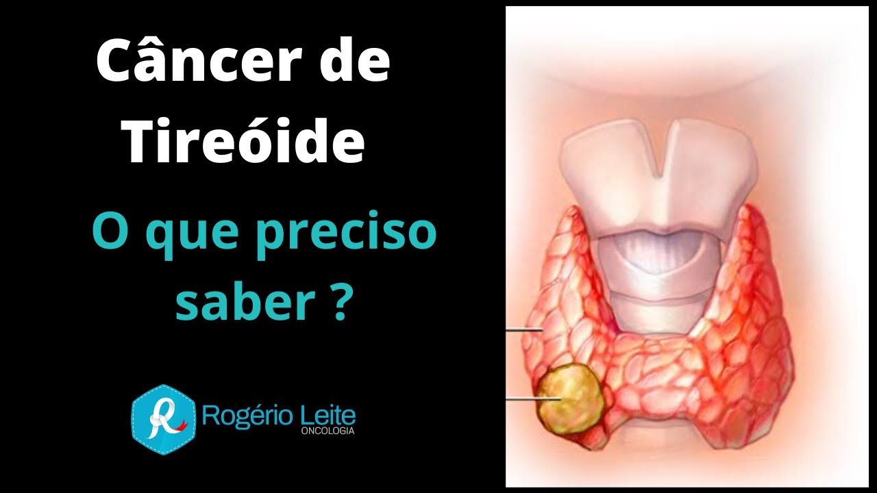 Cura cancer de garganta