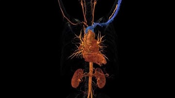 Arterial Checkup: Examine Blood Vessels with Contrast Agent