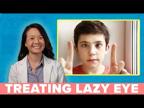 वीडियो: आलसी आँख का इलाज कैसे करें: 8 कदम (चित्रों के साथ)