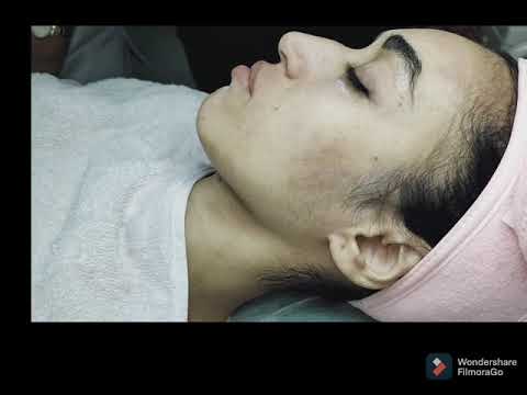 #ازالة شعر الوجه بالشمع بطريقة احترافية للمبتدءات (  épilation de visage a cire chaude)