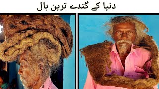 The Dirtiest Hair in the World, Haven't Washed Hair in Forty Years | دنیا کے گندے ترین بال