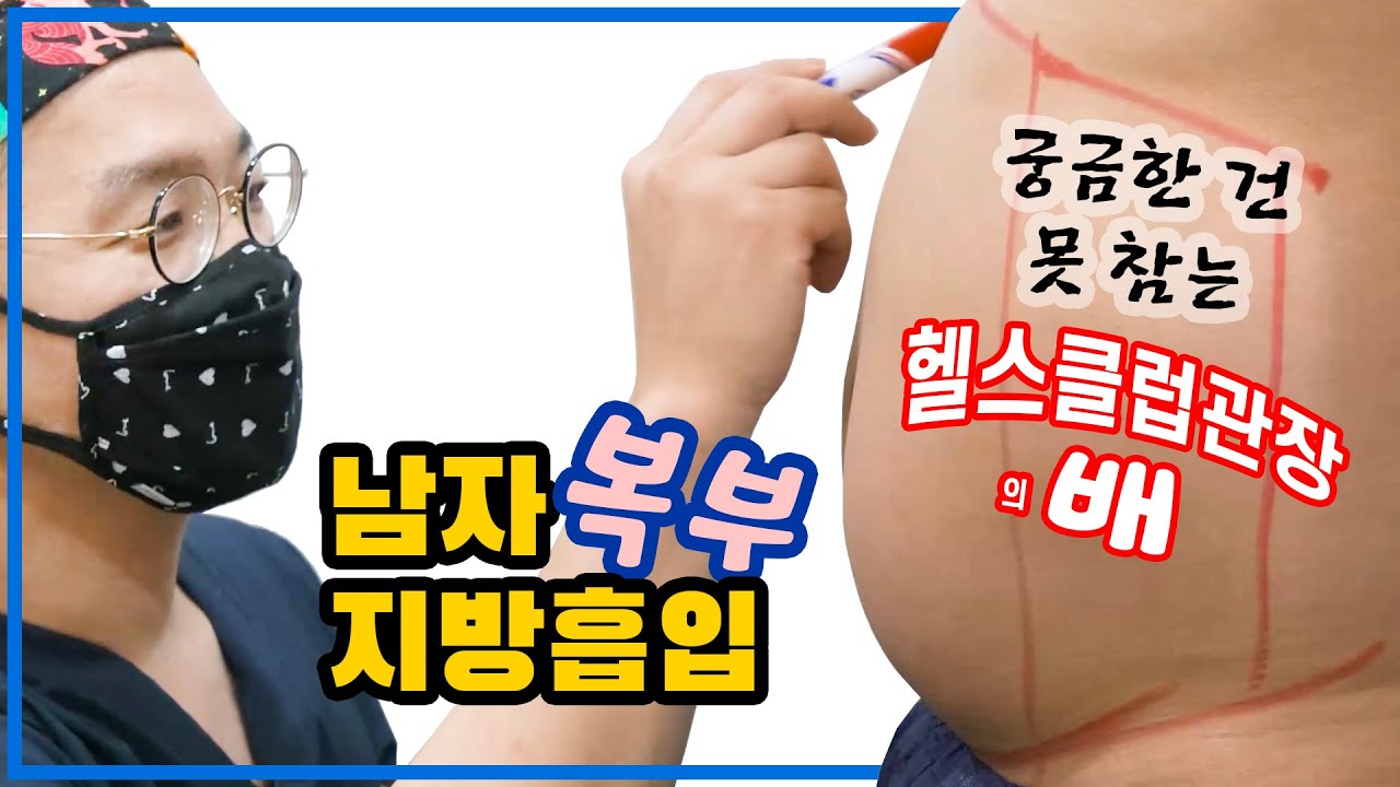 [남자 복부 지방흡입] 2개월 후의 결과도 확인하세요~ / 지방이라곤 복부밖에 없는 93kg의 근육맨 헬스클럽 김관장의 복부지흡 이야기!