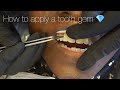 Gambar cover How To Apply Tooth Gems / Jewelry 💎