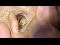 🎯極上の耳掃除 💫眠れない夜に効く耳かきASMR XS2342