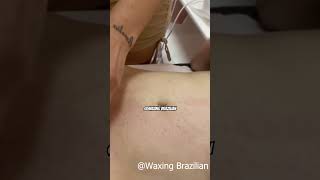 Brazilian wax