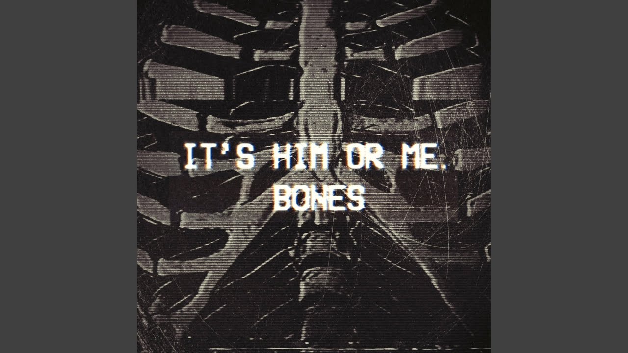 Bones