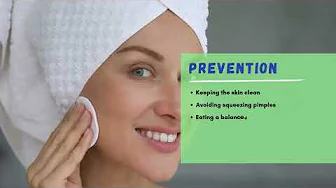 Is acne concerning?