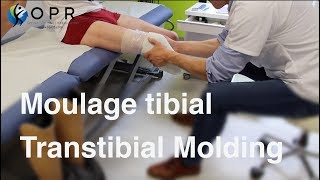 Moulage tibial pour la fabrication d’une prothèse à OPR Bretagne-Normandie