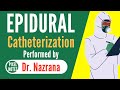 Epidural Anesthesia Procedure | Practical Video | Epidural Injection for Labor