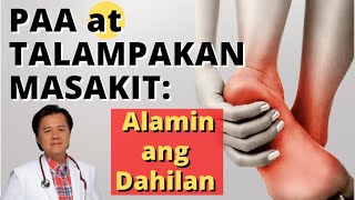 Paa at Talampakan Masakit: Alamin ang Dahilan  Payo ni Doc Willie Ong #1331