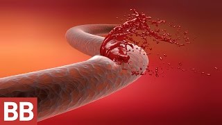 Alkolün 10 Zararı YouTube Videos