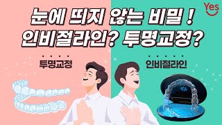 인비절라인? 투명교정? 눈에 띄지 않는 비밀 !!