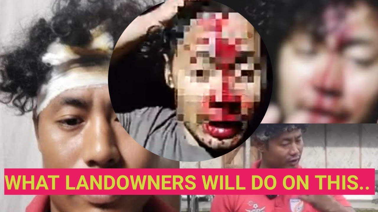 Naga Man Physically Assaulted By Four Non-Local Miyas 