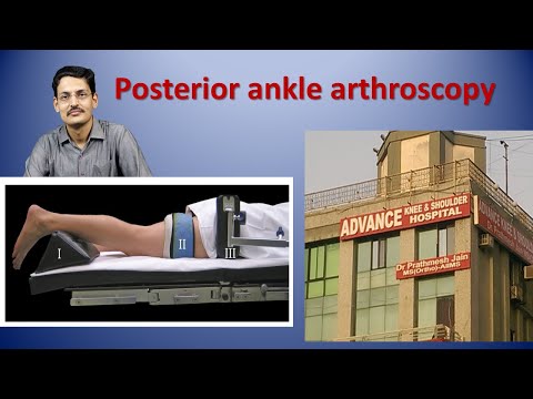 Posterior ankle arthroscopy