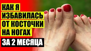 Вальгусная шина magnetfox купить 🎯 Растет косточка большого пальца ноги ⚡