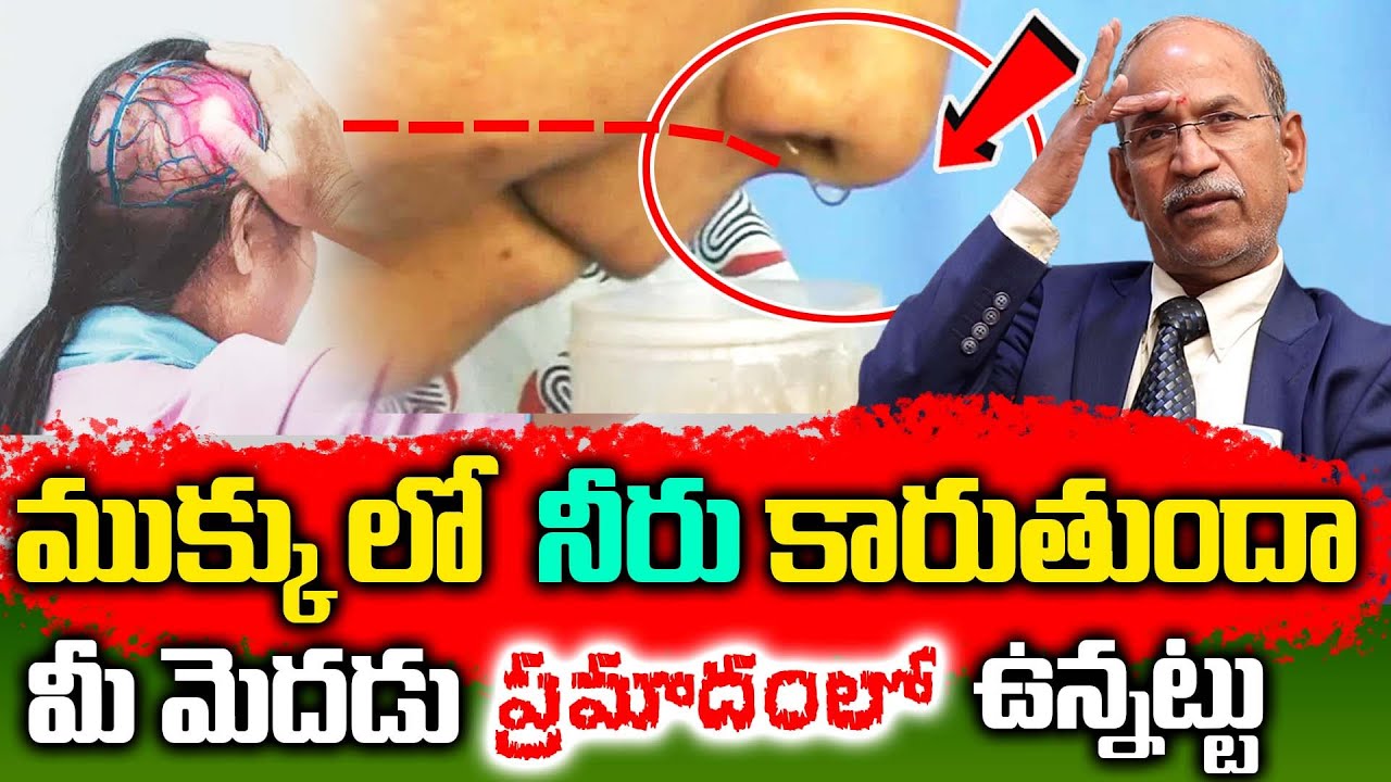 ముక్కు లో నీరు కారుతుందా, మీ మెదడులో ప్రమాదంలో ఉన్నట్టు  ! || Brain Fluid Leak || DR.Ranganadham