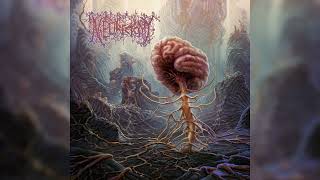 Neurectomy - "Overwrought" [Full Album]