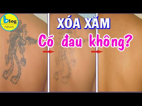 Video: Làm Thế Nào để Loại Bỏ Hình Xăm Không Thành Công Và Microblading: Các Phương Pháp Chính Và Tính Năng Của Chúng