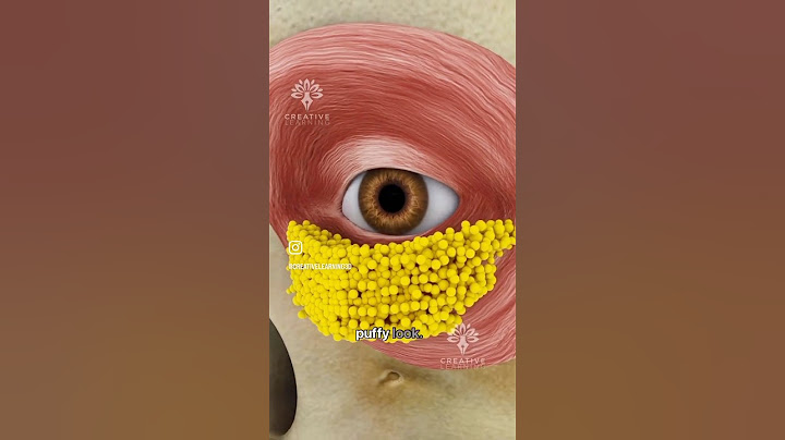 Why Do People Get Bags Under Their Eyes 😮 #shorts #viralvideo - Creativelearning3d