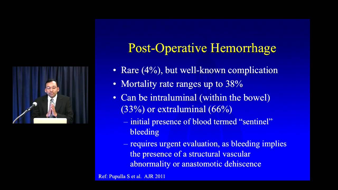 Pancreaticoduodenectomy