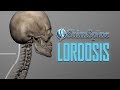 Lordosis