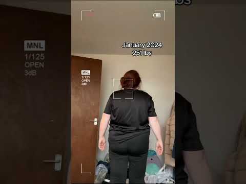 The Ozempic Weight Loss Craze