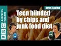 Teenager blinded by chips and junk food diet - News Review