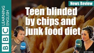 Teenager blinded by chips and junk food diet: BBC News Review