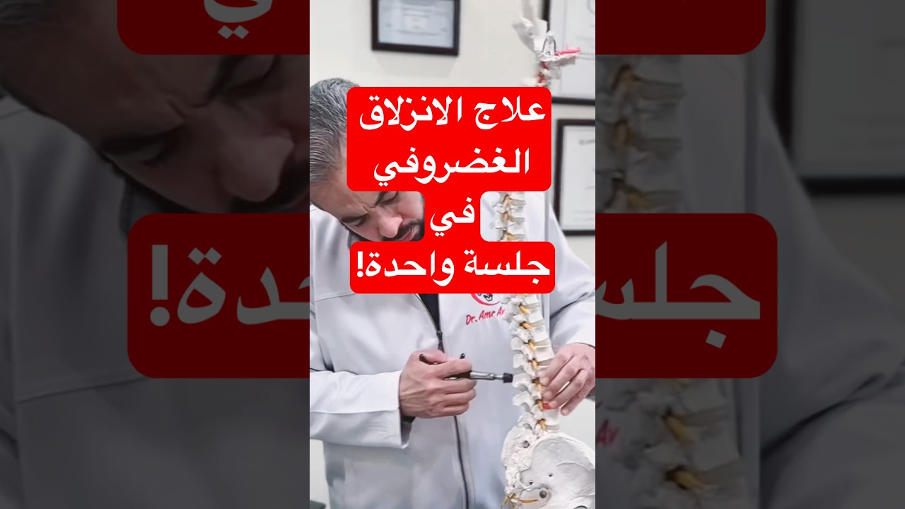 🛑 متصدقش الكلام ده! الانزلاق الغضروفي مش هيخف في جلسة واحدة! ⏳ خد وقتك في العلاج ومتجريش ورا الوهم!