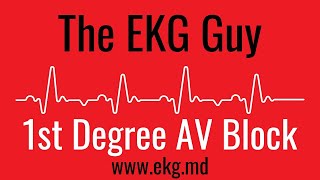 First Degree AV Block EKG l The EKG Guy - www.ekg.md