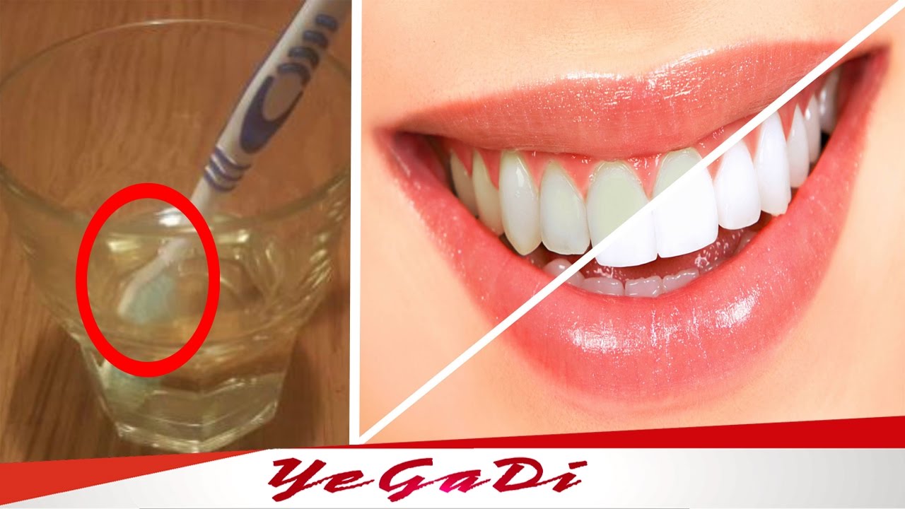 "Homemade" Natural Teeth Whitening With Just One Ingredient (3Minute