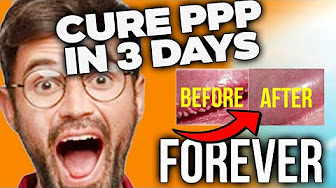 papules pearly
