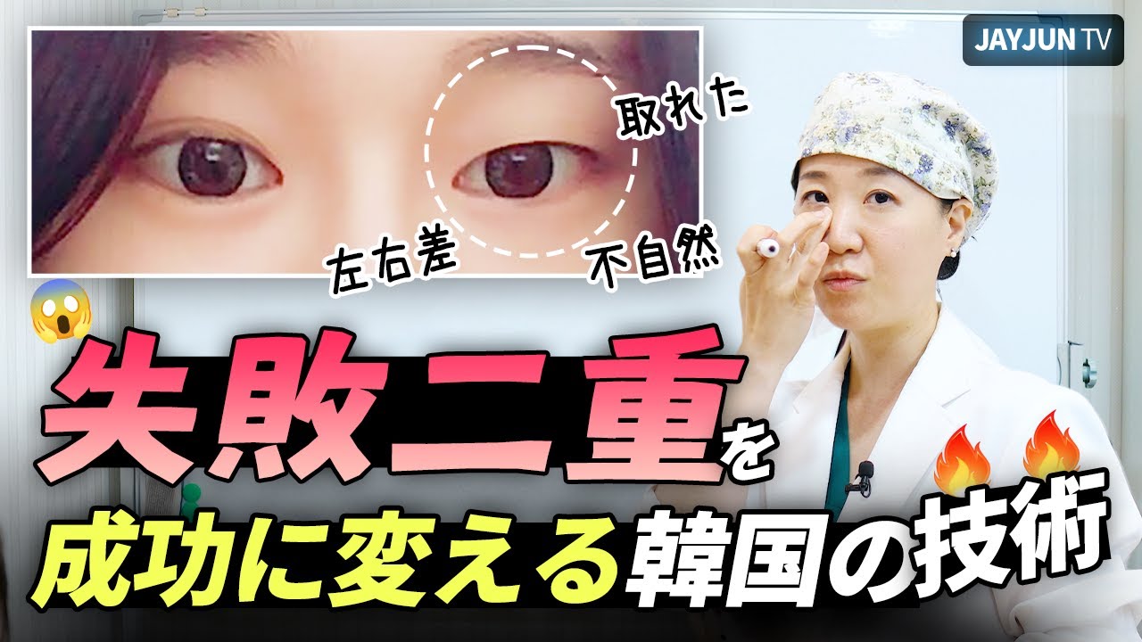 #目整形 #目の再手術 #目修正手術 #二重 #目つき矯正 #ジェイジュン美容外科