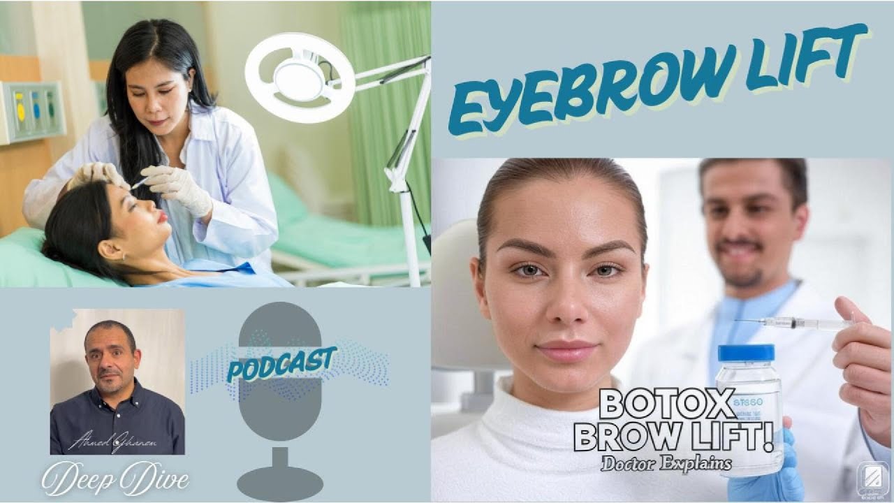 Botox for Eyebrow Lift