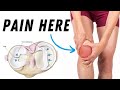 Meniscus Injury treatment, cause, symptoms, diagnosis and management early stage