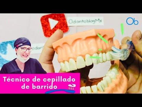 Técnica de cepillado de BARRIDO