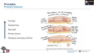 Orthoplastic Surgery: Management of Soft Tissue Injuries in Lower Extremity Traumas screenshot 2