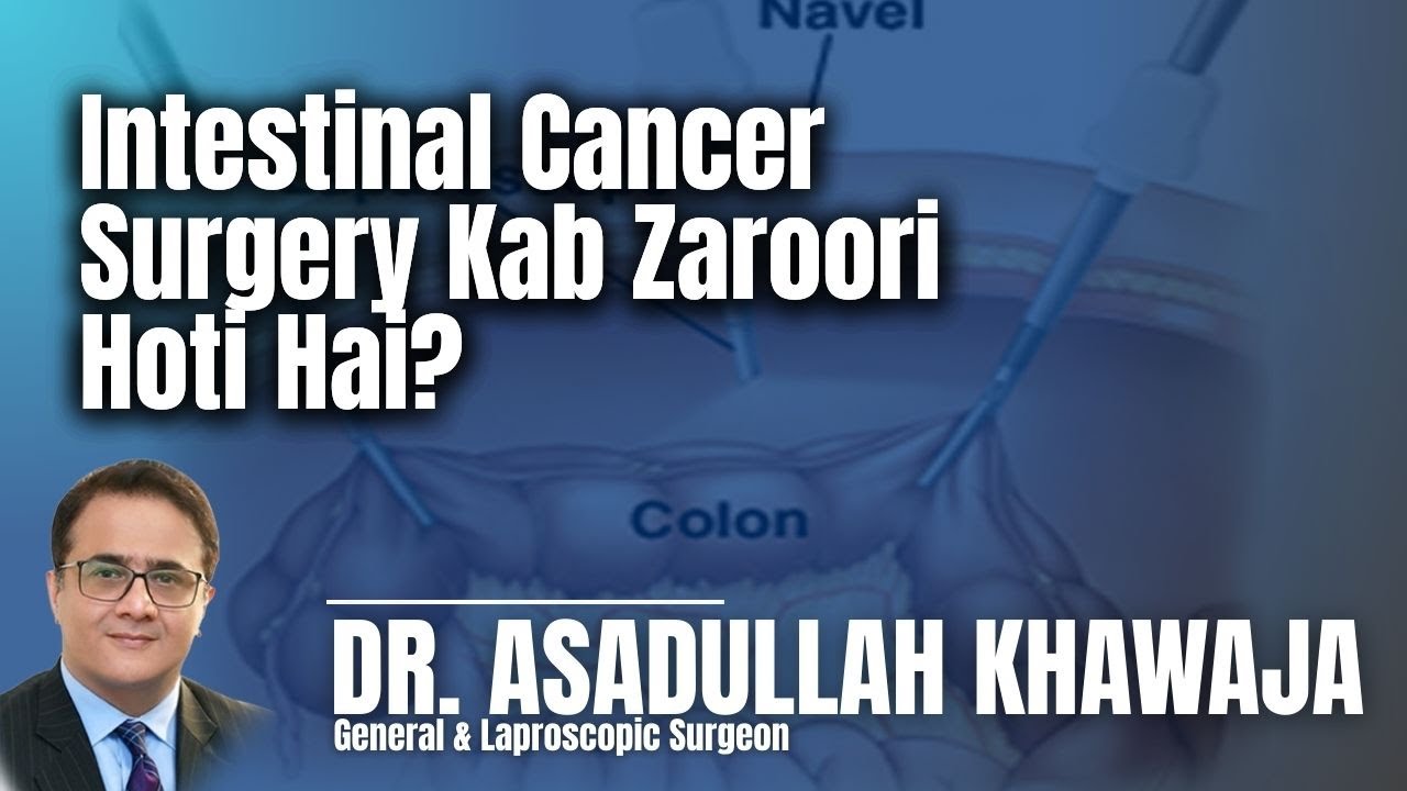 Intestinal Cancer Surgery Kab Zaroori Hoti Hai?