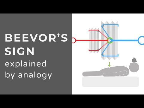 Beevor's Sign | Lower Thoracic Cord Lesions & Myopathies | Animation | Explained Conceptually
