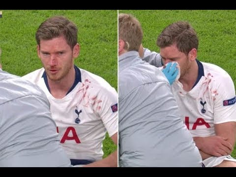 Jan Vertonghen Injury