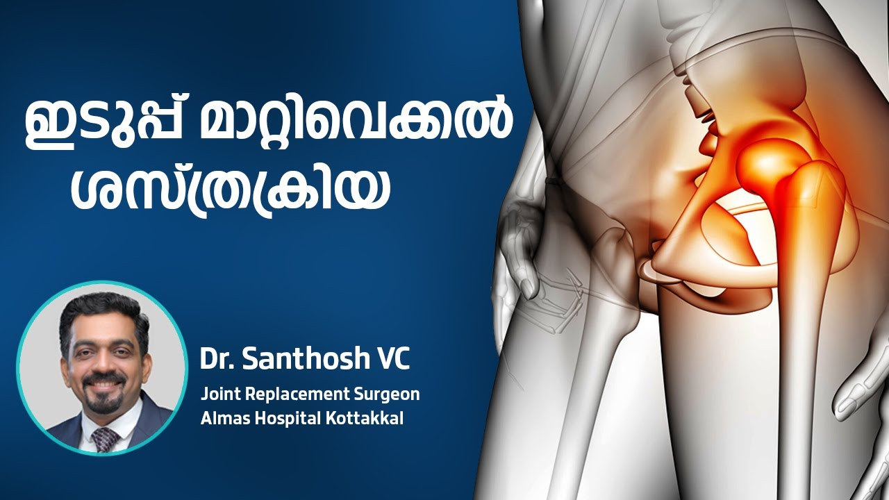ഇടുപ്പ് മാറ്റിവയ്ക്കൽ ശസ്ത്രക്രിയ | Hip Replacement | Almas Hospital ,Kottakkal