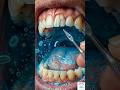 Travel Dental Kit #TravelDentalKit #DentalCare#TravelEssentials#OralCare #DentalTools#TravelHacks