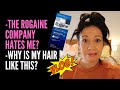 HONEST HAIR LOSS CREATOR PROBLEM: ROGAINE WILL NEVER SPONSOR ME + 5MIN HAIRSTYLE TRICK FOR THIN HAIR