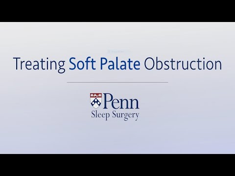 Treating Soft Palate Obstruction | Penn Sleep Surgery