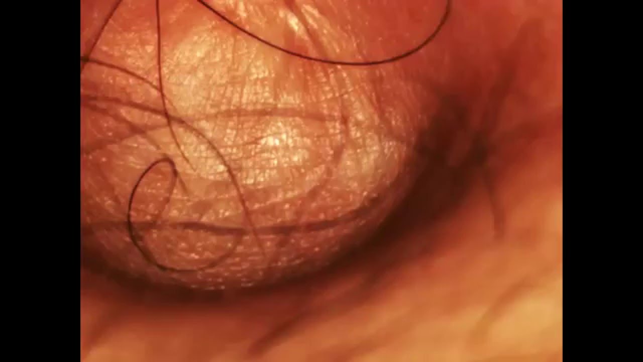 Close up belly button Close up belly button