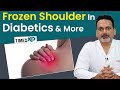 Frozen shoulder problem in diabetics  doctor explains what is frozen shoulder  timesxp health
