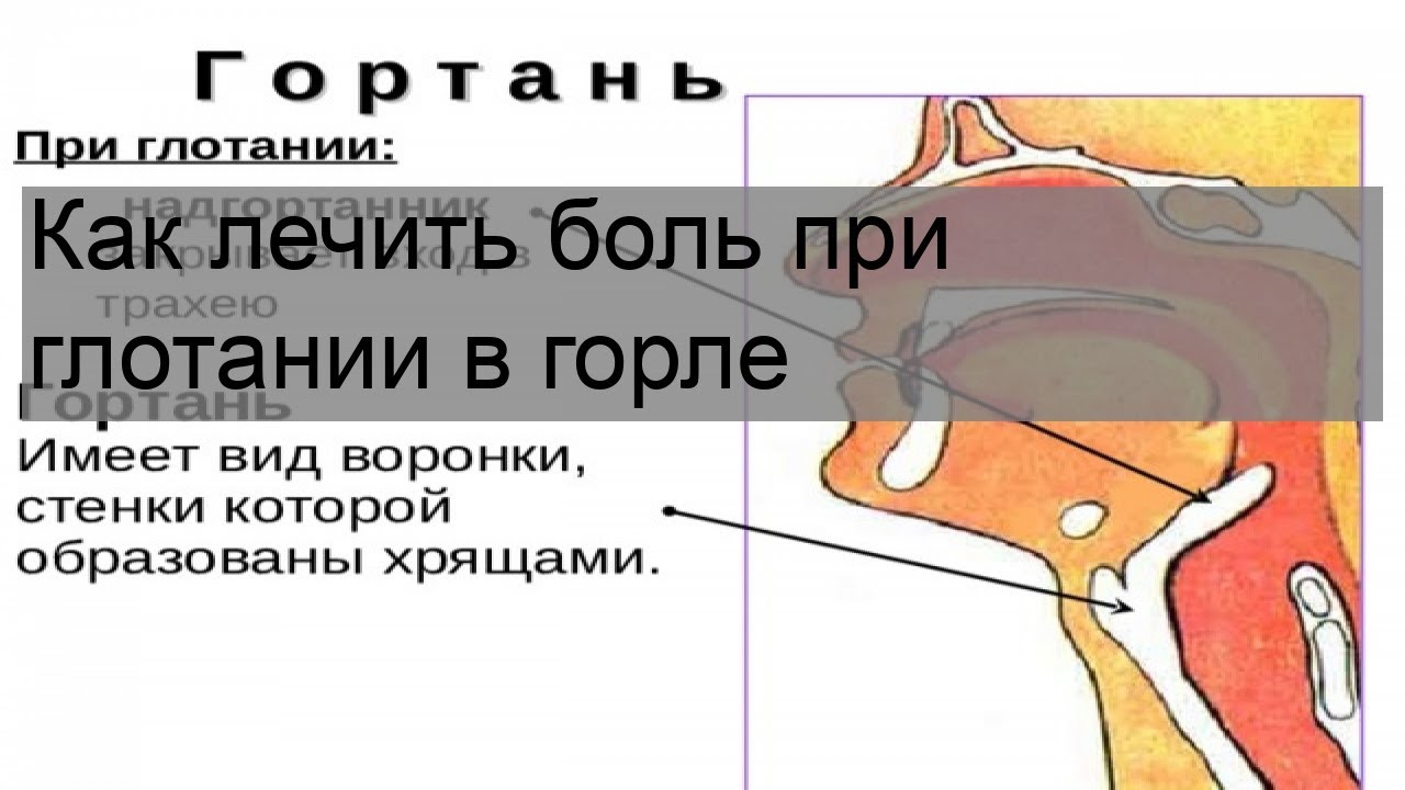 Почему когда глотаешь щелкает. Боль в горле при глотании. Воспаление голосовых связок.