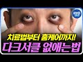 다크서클을 만드는 ‘이 습관‘ 하지마세요! | 다크서클 다크서클종류 다크서클없애는법 다크서클홈케어 다크서클치료 아이크림 아이크림추천