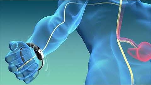 Reliefband Premier Motion Sickness Wristband - 2 Pack - Easy-to-Use, Fast, Drug-Free Nausea Relief